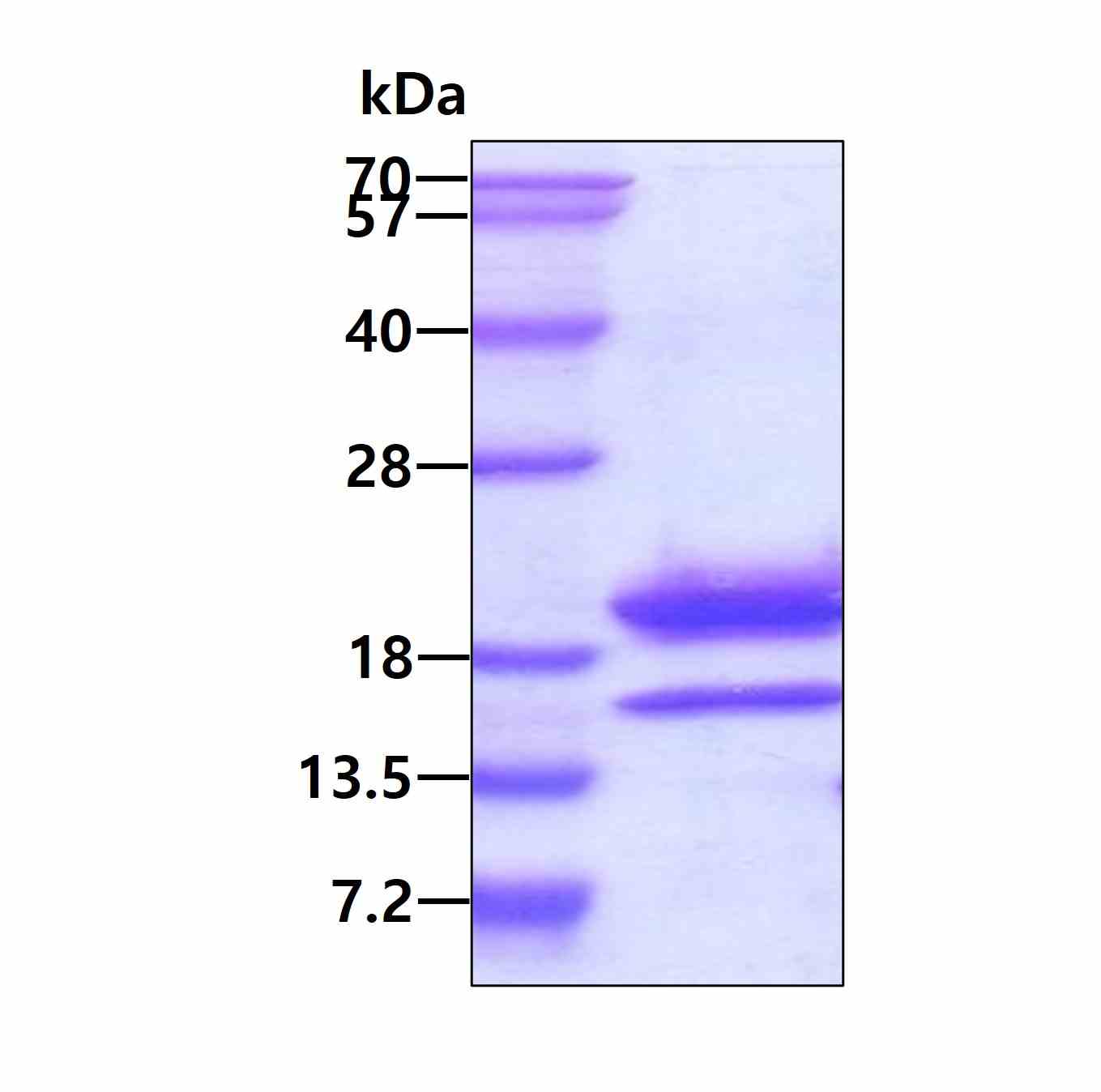 3 μg by SDS-PAGE under reducing condition and visualized by coomassie blue stain